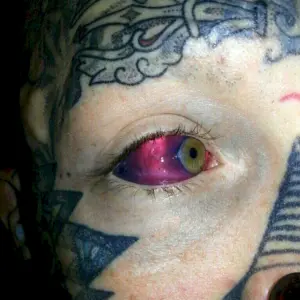 Татуировки на белках глаз
